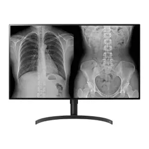 Monitor LG 80 cm (31,5") 32HL512D-B 3840x2160 Medicina IPS 5ms HDMI 2xDisplayPort 2xUSB2.0 Pivot  3H DCI-P3-98% HDR10 Diagnostic 4/6/8MP - CR, CT, Endoscopy